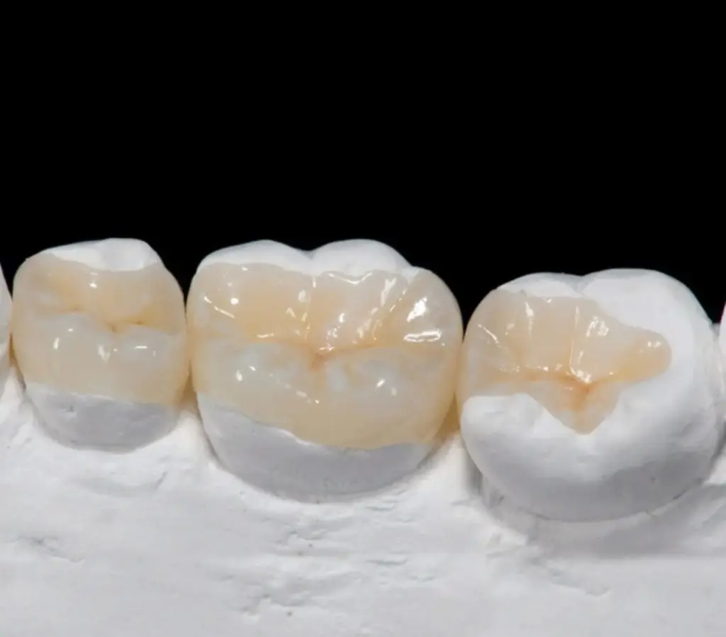 incrstación disilicato de litio