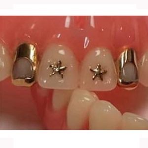 oro de 24 especial para prótesis dentales