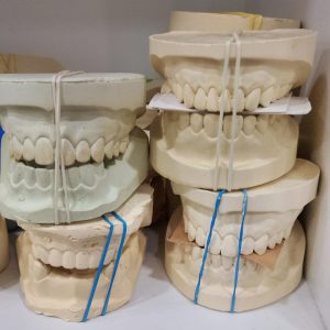 MODELO DE YESO DENTADO, EDENTULO, PARCIAL