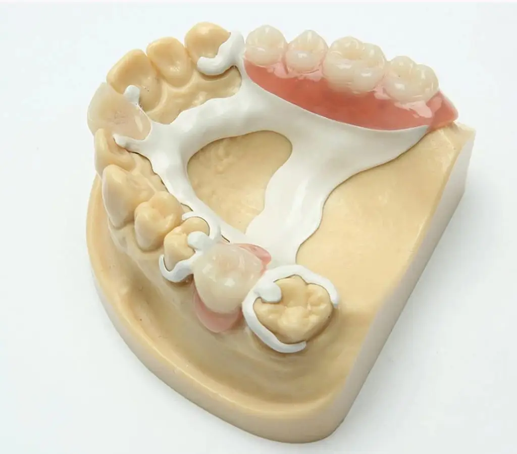 estructura removible peek combinada con acrilico o flexible