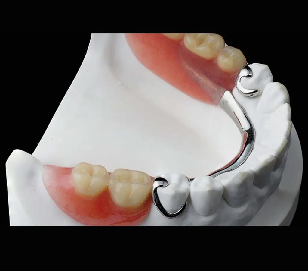 protesis combinada con flexible